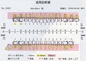 歯周診断書　2009.09.08　歯周ポケットの深さは３～４ｍｍ