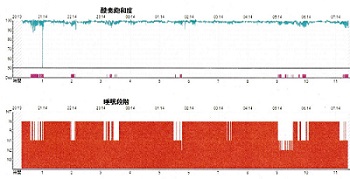 血中酸素飽和度（ＳｐＯ２）と睡眠段階―睡眠ポリグラフィー結果 2018.08.23