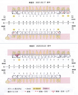 歯ぐきの健康状態―歯周診断書